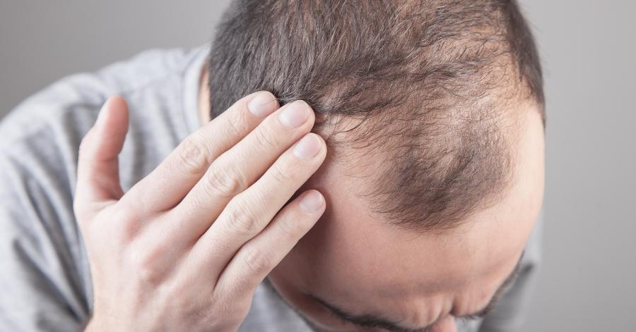 Hair loss and scalp care diagnostic assessment